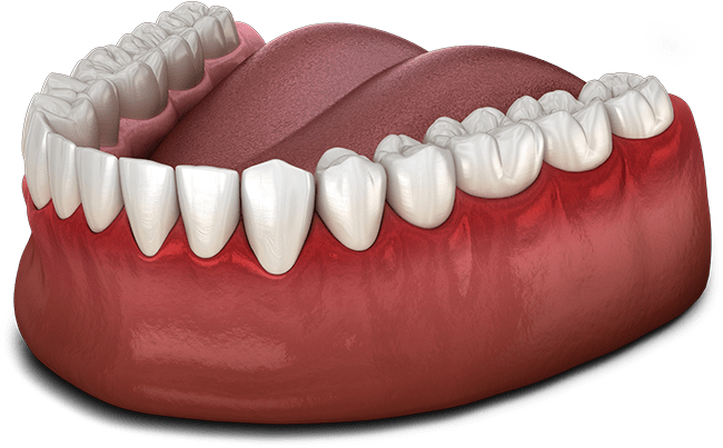 gum disease model