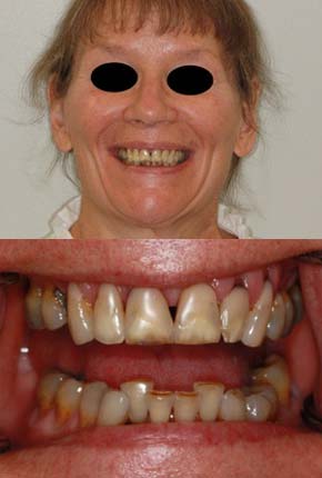 woman suffering from gum disease