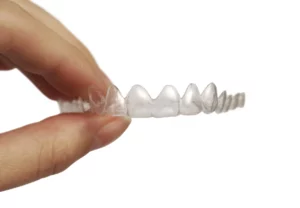 A clear picture of Invisalign
