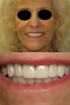 Glowing white teeth