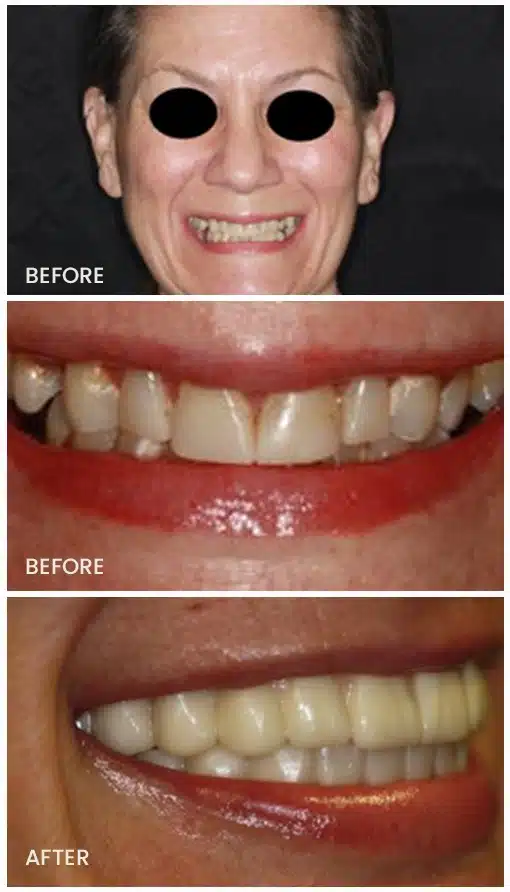 before and after patient testimonial