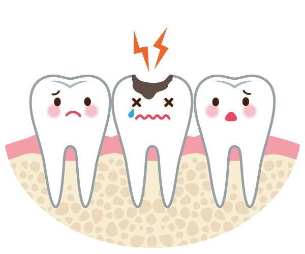 5 Common Causes of Intense Tooth Pain
